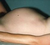 pregnant trimester alisya milono prego
